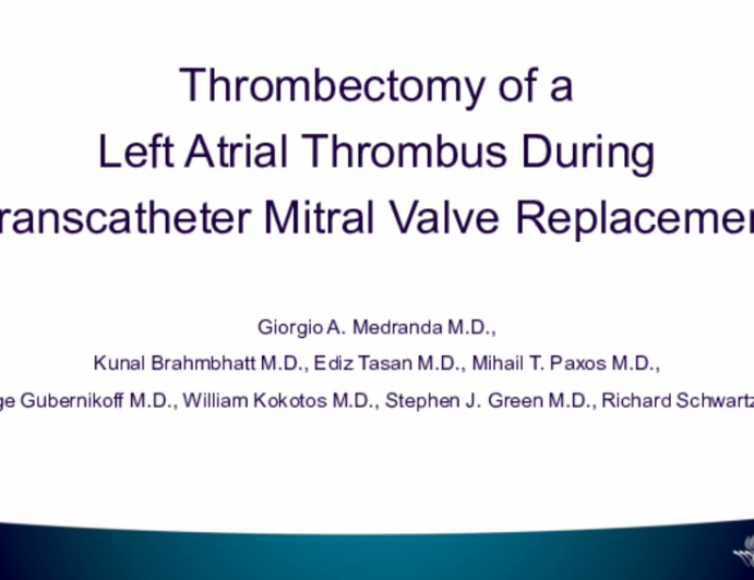 Thrombectomy of a  Left Atrial Thrombus During  Transcatheter Mitral Valve Replacement