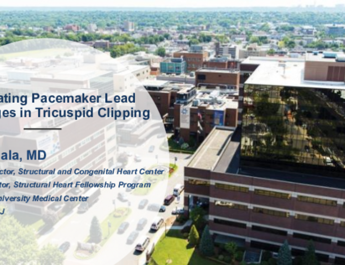 Navigating Pacemaker Lead Challenges in Tricuspid Clipping