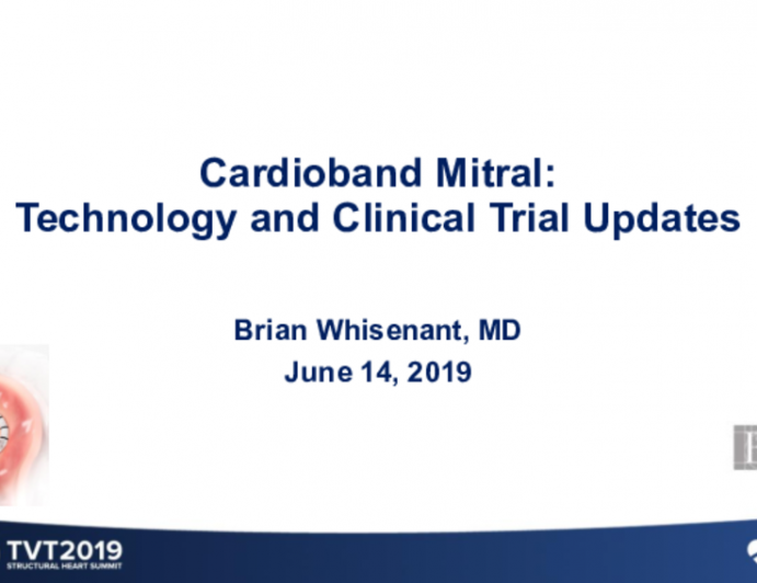 Cardioband Mitral: Technology and Clinical Trial Updates (ACTIVE)