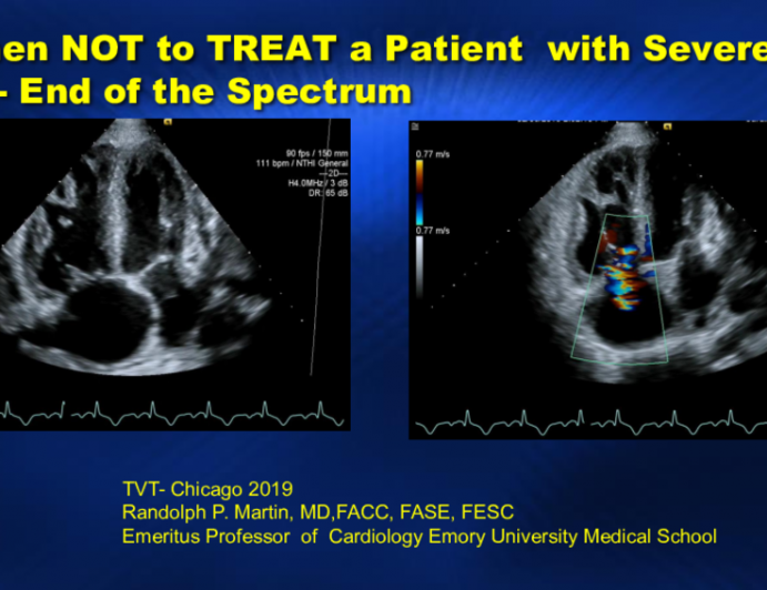 When NOT to TREAT a Patient With Severe TR – Ends of the Spectrum