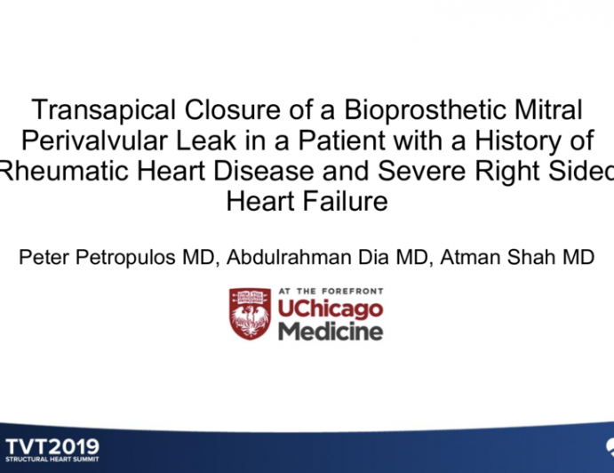 Transapical Closure of a Bioprosthetic Mitral Perivalvular Leak in a Patient With a History of Rheumatic Heart Disease and Severe Right-Sided Heart Failure