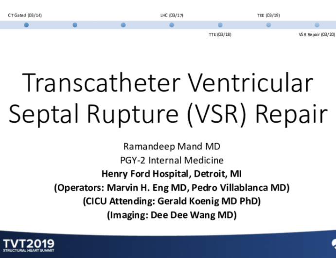 Transcatheter Ventricular Septal Rupture Repair