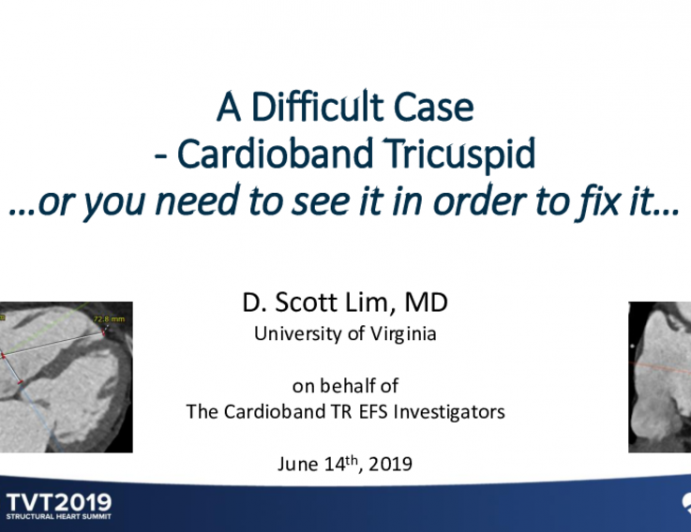 Case 1: A Difficult Case Treated With Cardioband
