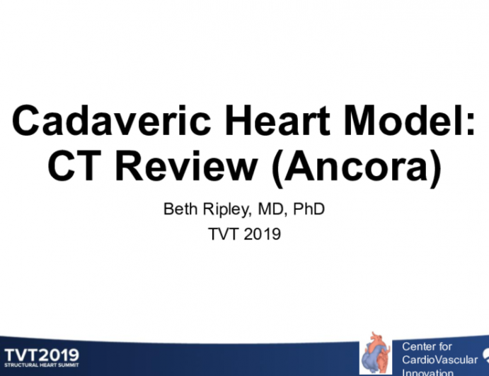 CT review