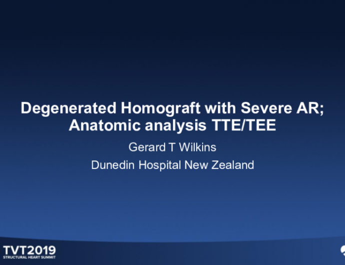 Anatomic Analysis TTE/TEE