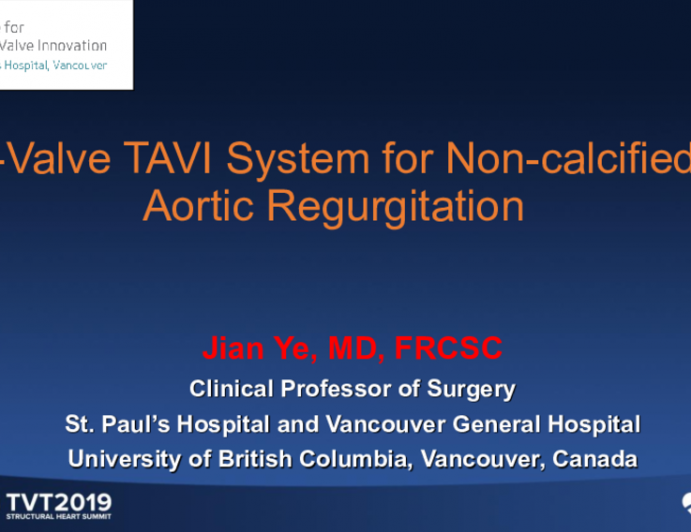 Case: J-Valve for Pure Aortic Regurgitation