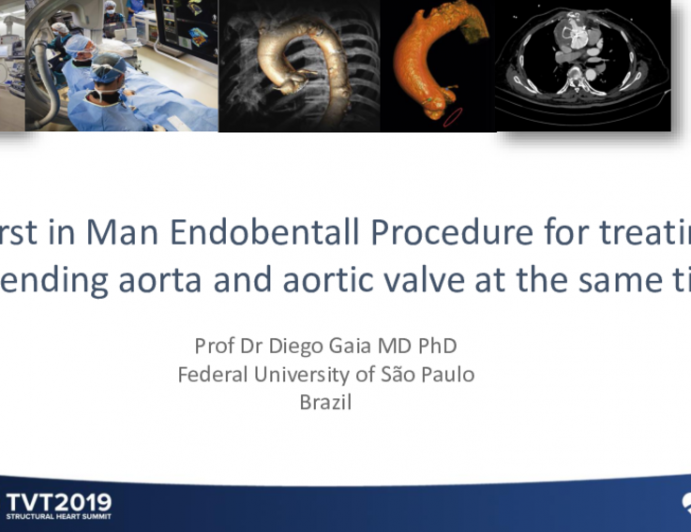 First in Man Endobentall Procedure for Treating Ascending Aorta and Aortic Valve at the Same Time