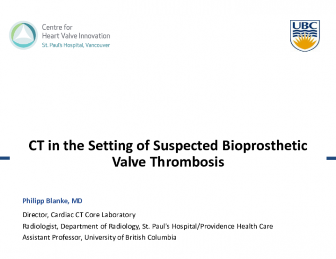 CT in the Setting of Suspected Bioprosthetic Valve Thrombosis