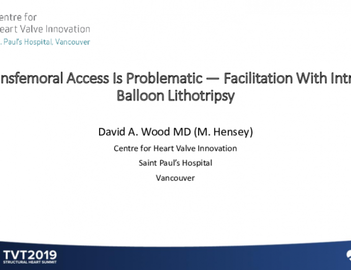 When Transfemoral Access Is Problematic — Facilitation With Intravascular Balloon Lithotripsy