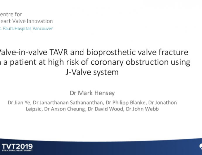 Use of a New-Generation Transcatheter Heart Valve Facilitating Valve-in-Valve TAVR and Bioprosthetic Valve Fracture in a Patient at High Risk of Coronary Obstruction