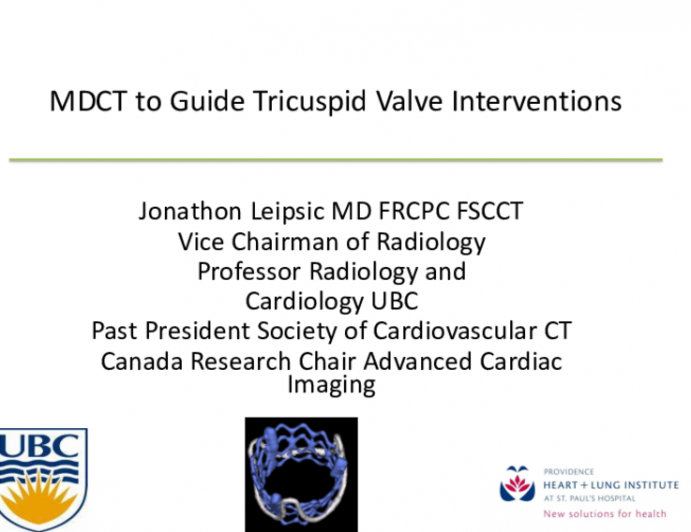 The ‘Essential’ CT Examination of the Tricuspid Annulus and RV Anatomy