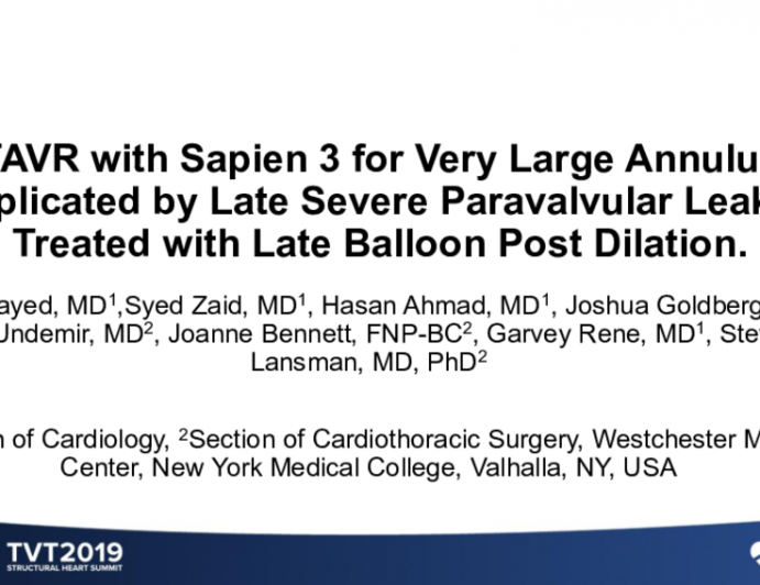 TAVR With Sapien 3 for Very Large Annulus Complicated by Late Severe Paravalvular Leak and Treated With Late Balloon Post-Dilation