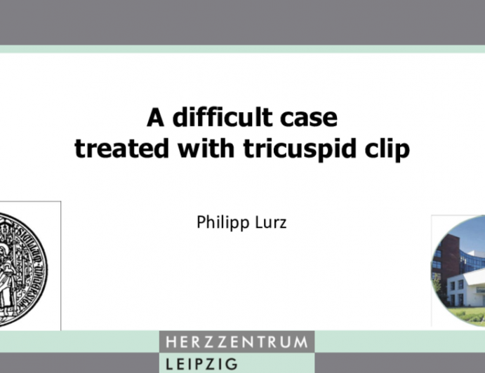 Case 4: A Difficult Case Treated With Tricuspid Clip