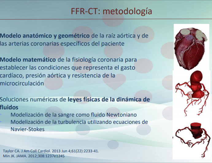 Evaluación funcional no invasiva (y sin adenosina): FFR-CT