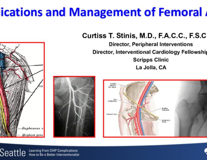 Complications and Management of Femoral Access