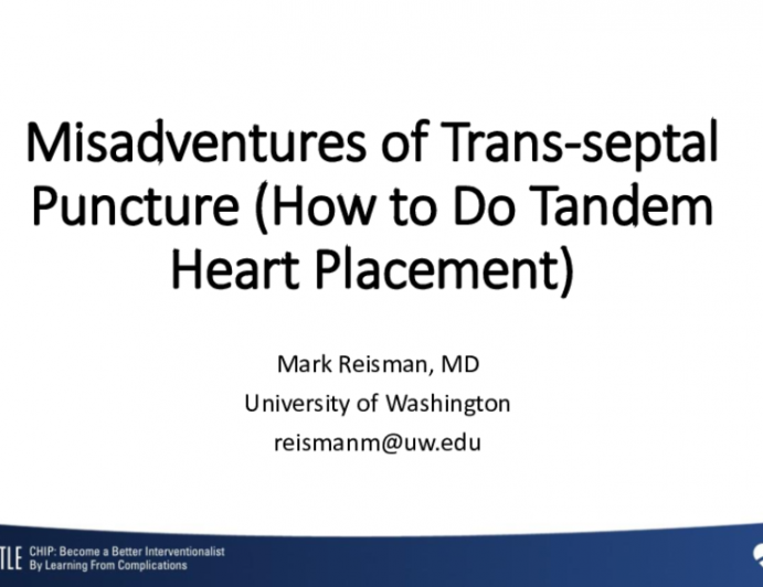 Misadventures of Trans-septal Puncture (How to Do Tandem Heart Placement)