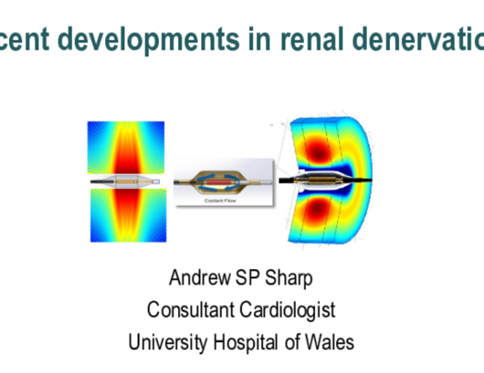 In Case You Missed It: What’s Happened (So Very) Recently in Renal Denervation