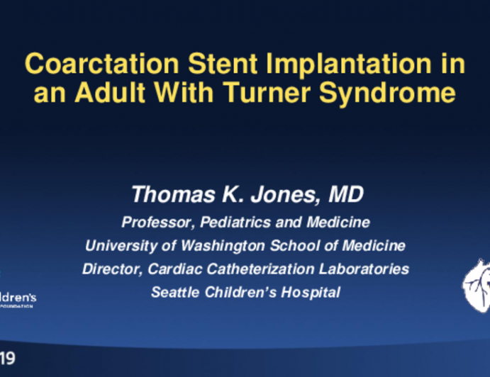 Coarctation Stent Implantation in an Adult With Turner