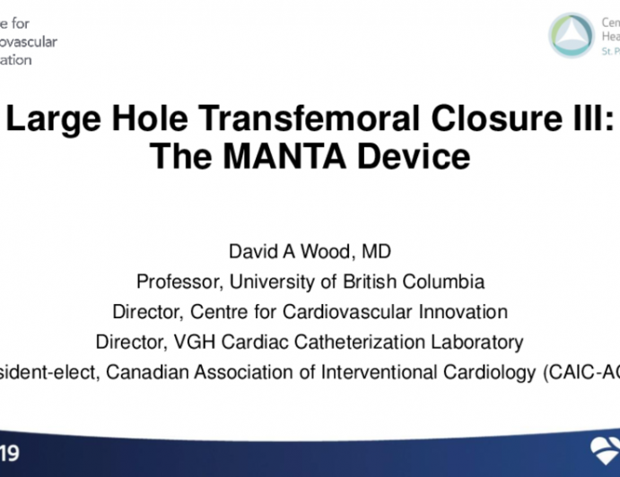 Novel Large-Hole Access Closure Devices - Large-Hole Transfemoral Closure III: The MANTA Device