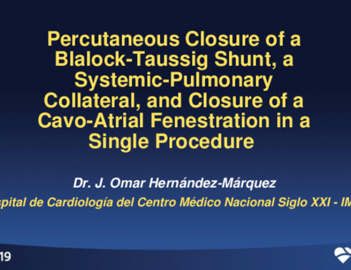 Case 2 (B): Percutaneous Closure of a Blalock-Taussig Shunt, a Systemic-Pulmonary Collateral, and Closure of a Cavo-Atrial Fenestration in a Single Procedure