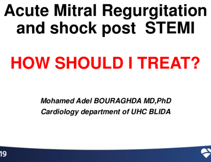A Patient With STEMI, MVD, and Cardiogenic Shock - How I Would Treat This Case