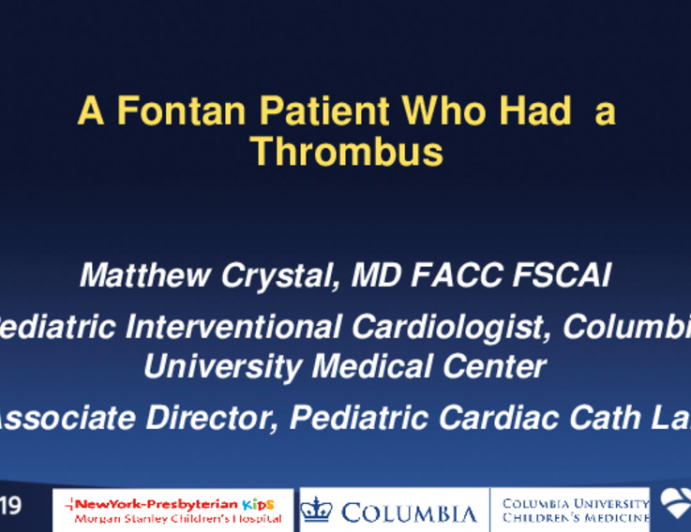 A Fontan Patient Who Had a Thrombus