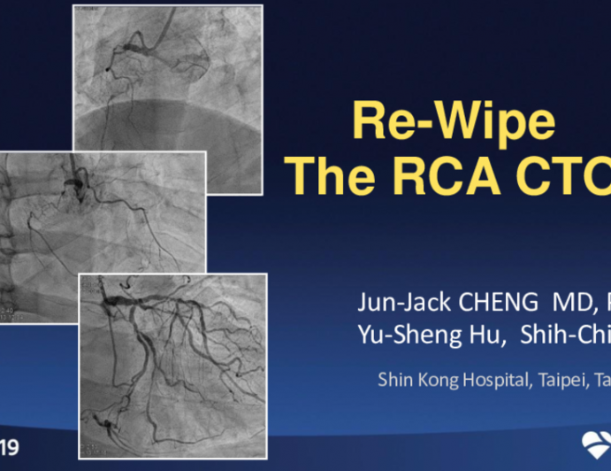 Taiwan Presents: Re-Wipe the RCA CTO