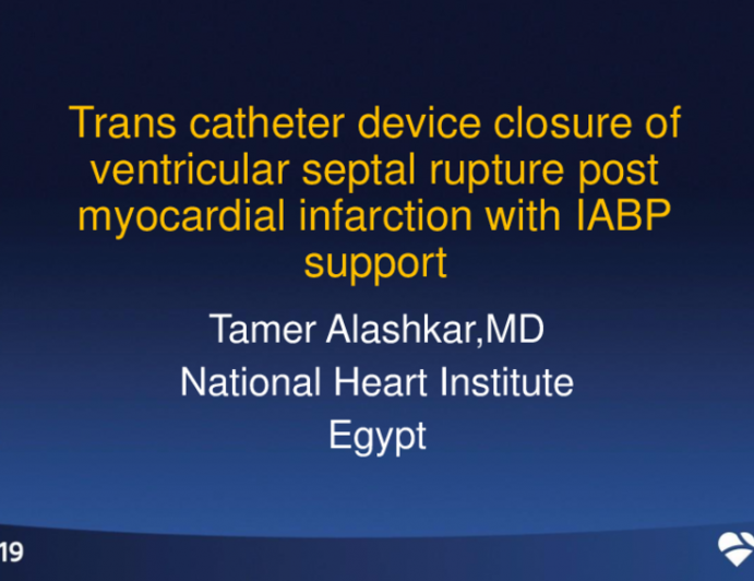 Ventricular Septal Rupture Post-Myocardial Infarction: Transcatheter Device Closure Assissted With Intra-Aortic Ballooon Pump