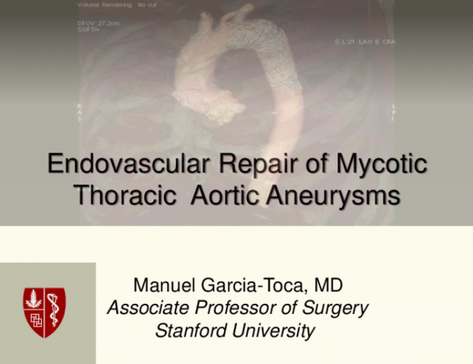 Endovascular Repair of Mycotic Aneurysms of the Thoracic Aorta