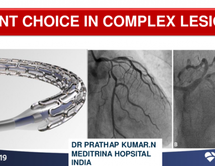 Session III: DES - Stent Choice in Complex Lesions: How the Unique Stent DNA Can Help Improve the Patient Outcomes