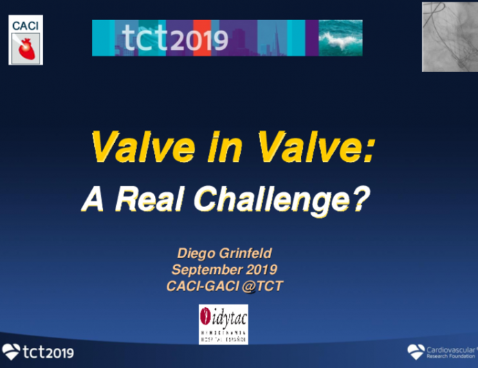 TAVI Valve-in-Valve: A Real Challenge?