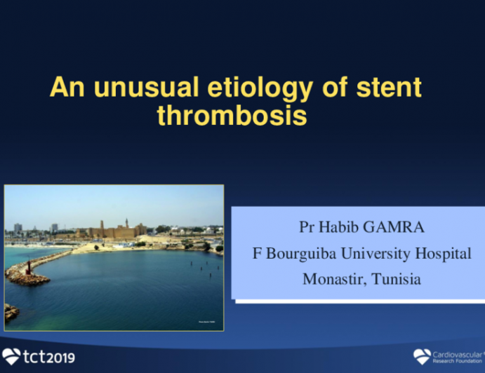 Tunisia Presents: An Unusual Etiology of Stent Thrombosis