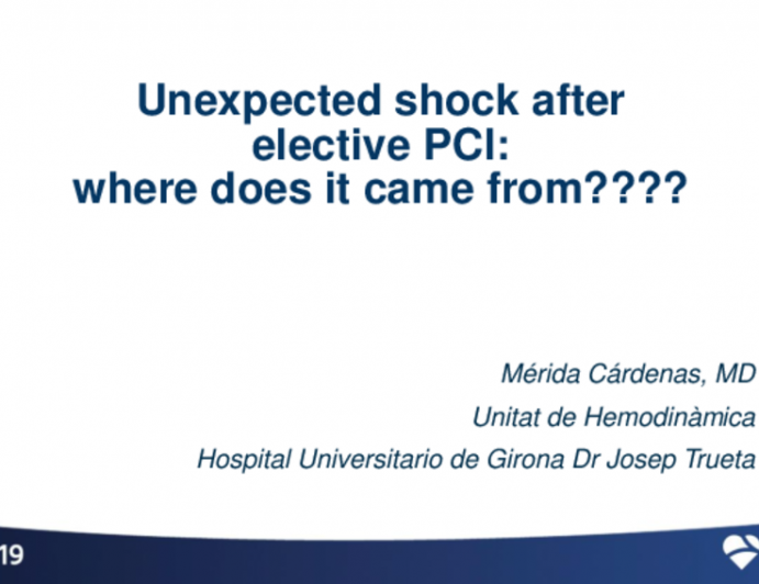 Unexpected Shock: Where Does It Come From?