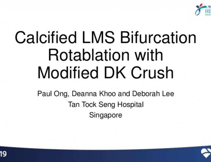 Singapore Presents: Calcified Left Main Stem Bifurcation Angioplasty Using Rotational Artherectomy