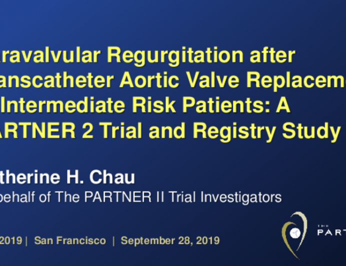 TCT 2: Paravalvular Regurgitation after Transcatheter Aortic Valve Replacement in Moderate Risk Patients: A Pooled PARTNER 2 Trial and Registry Study