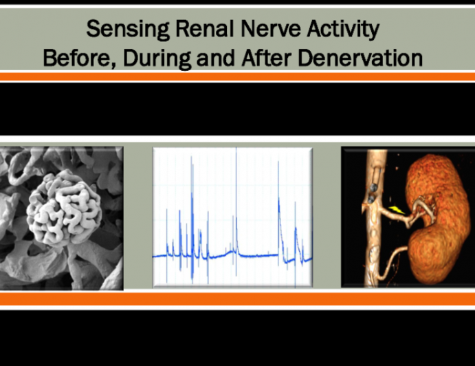 Sensing Renal Nerve Activity Before, During, and After Denervation I: Autonomix