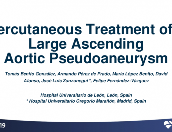 Spain Presents: Percutaneous Treatment of a Large Ascending Aortic Pseudoaneurysm