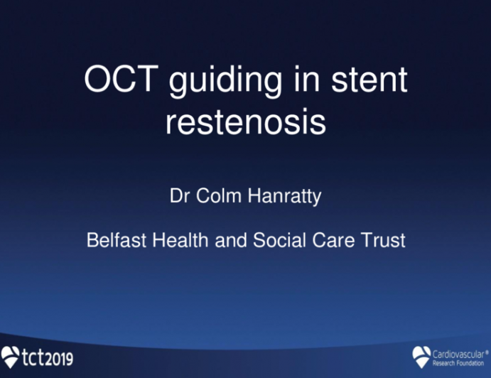 Case #3: Same Strategy With or Without OCT in ISR?