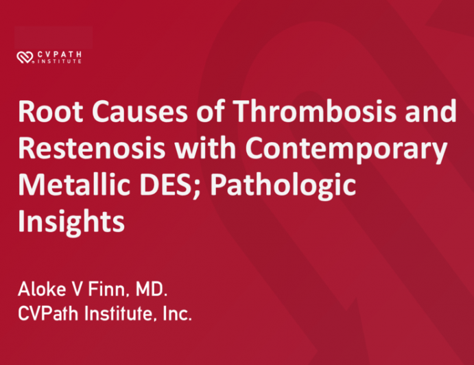 Root Causes of Thrombosis and Restenosis With Contemporary Metallic DES: Pathologic Insights