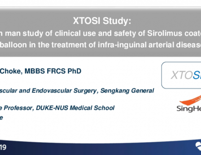 XTOSI Study: First-in-Man Study of Clinical Use and Safety of Sirolimus-Coated PTA Balloon in the Treatment of Infrainguinal Arterial Disease