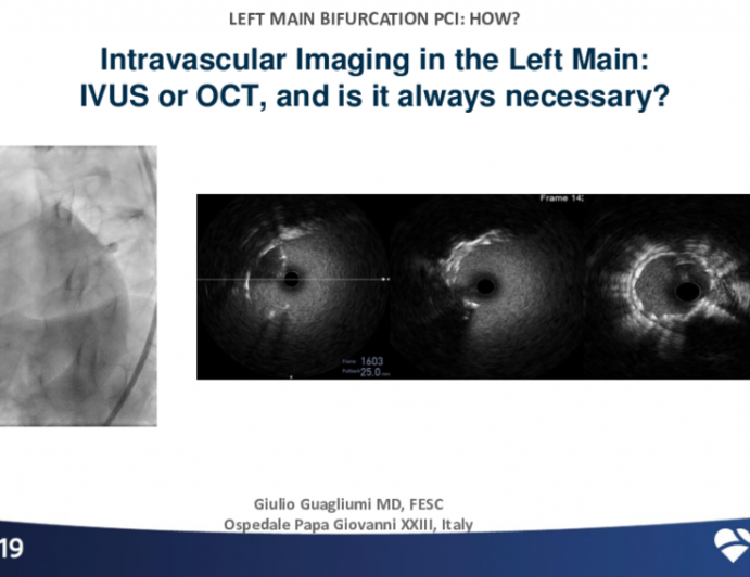 Intravascular Imaging in the Left Main: IVUS or OCT, and Is It Always Necessary?