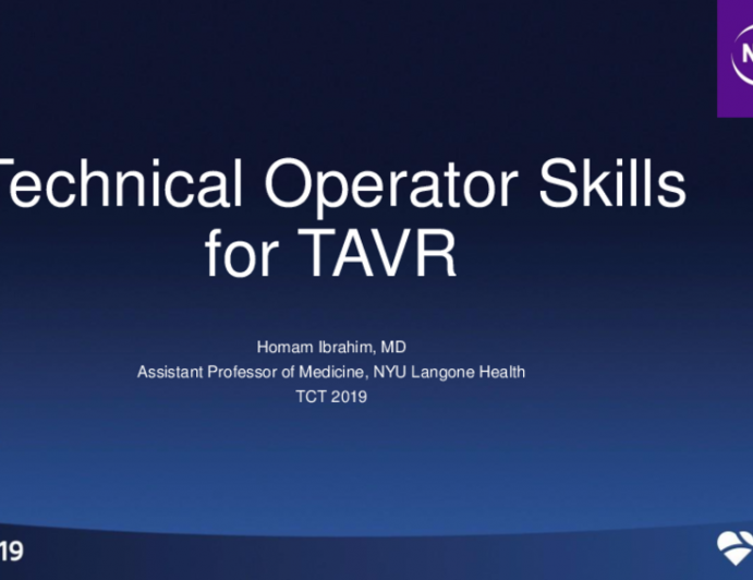 Acquiring Advanced - Technical Operator Skills