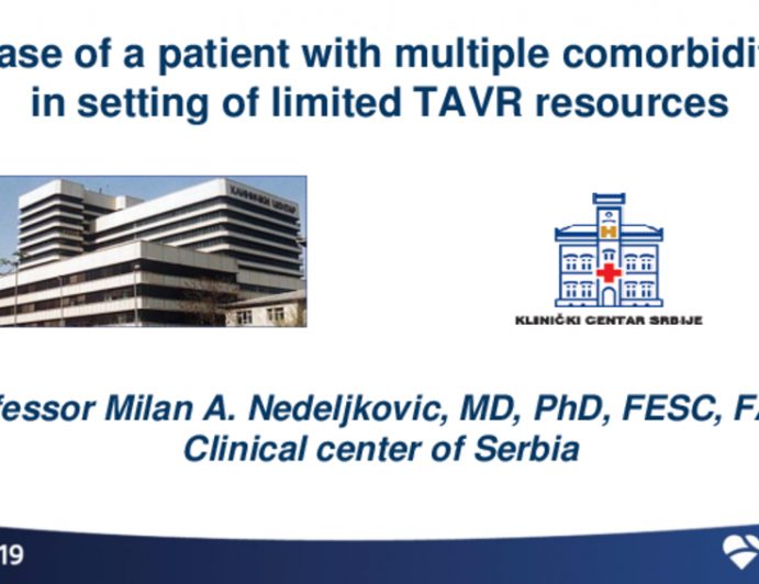 Serbia Presents: A Case of a Patient With Multiple Comorbidities in Setting Limited TAVR Resources