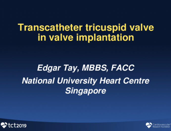 Case 6 (From Singapore): Transcatheter Tricuspid Valve-in-Valve Treatment