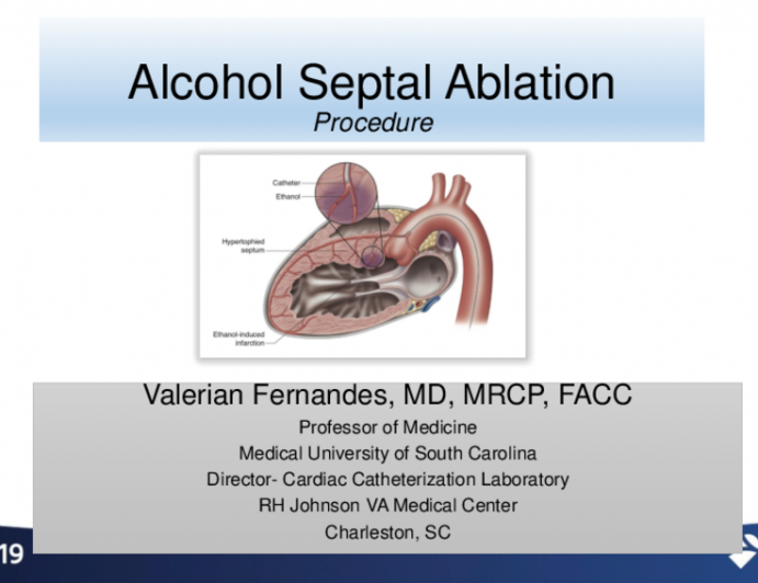 The Alcohol Septal Ablation Procedure