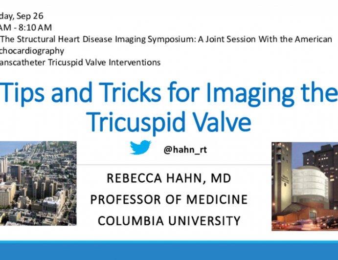 Echocardiographic Imaging of the Tricuspid Valve:Tips and Tricks