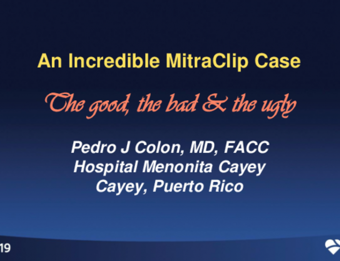 An Incredible MitraClip Case