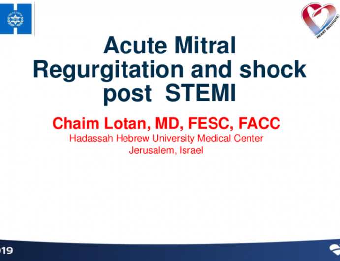 A Patient With STEMI, MVD, and Cardiogenic Shock - Case Introduction