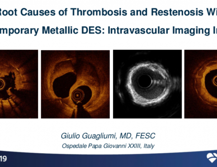 Root Causes of Thrombosis and Restenosis With Contemporary Metallic DES: Intravascular Imaging Insights