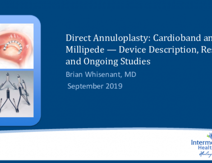 Direct Annuloplasty: Cardioband and Millipede — Device Description, Results, and Ongoing Studies